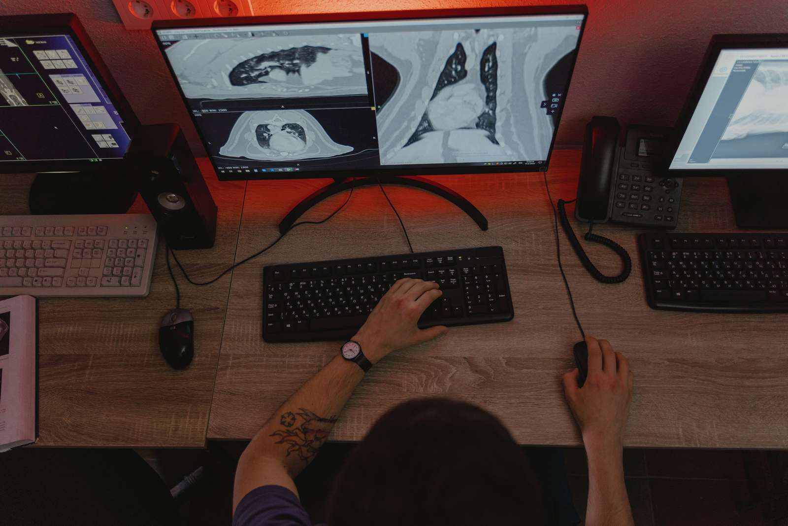 A radiologist reviewing x-ray scans on multiple monitors at a desk