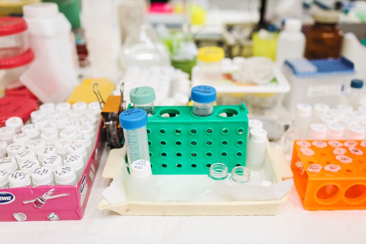 Racks of sample tubes in a laboratory