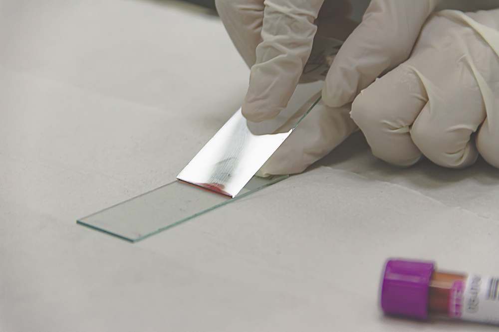 A scientist preparing a glass slide with a specimen