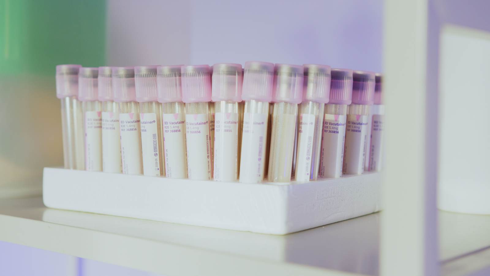 A row of laboratory test tubes with pink caps