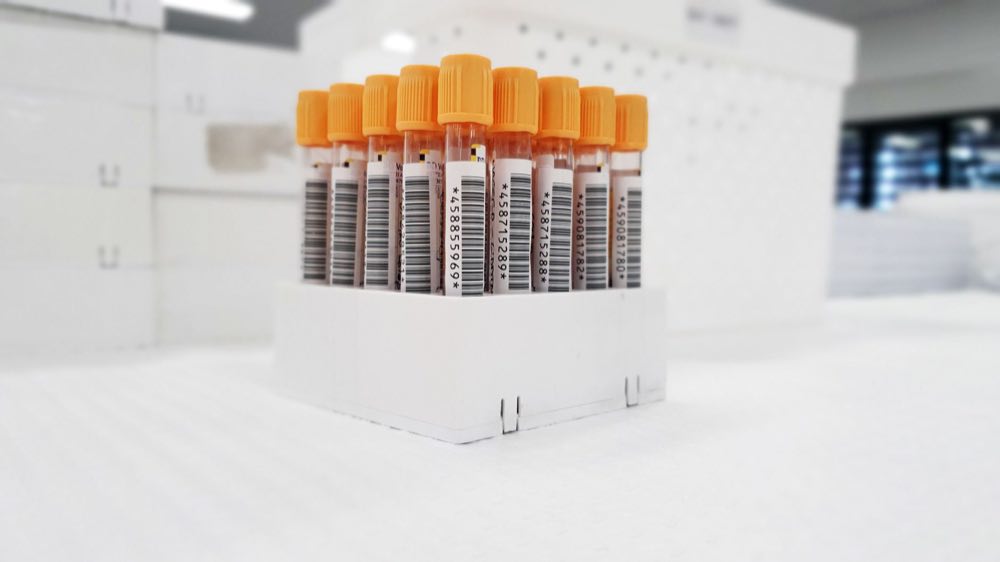 Rack of barcoded specimen tubes in a clean laboratory
