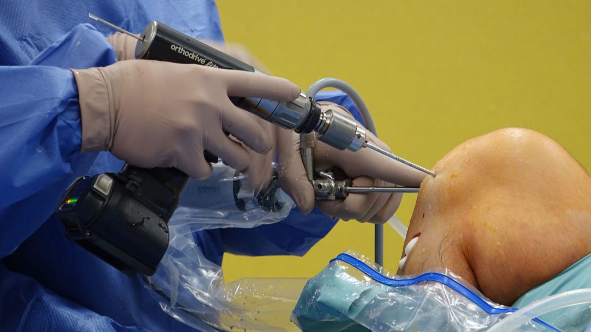 Orthopaedic surgeons performing arthroscopic knee surgery