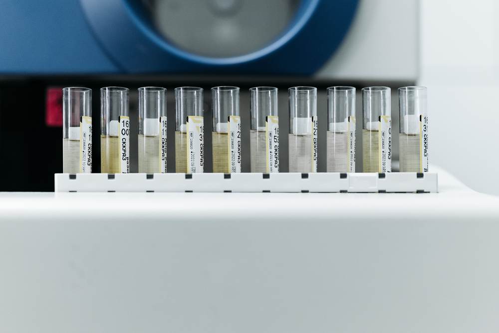 Labeled samples on a rack in a laboratory