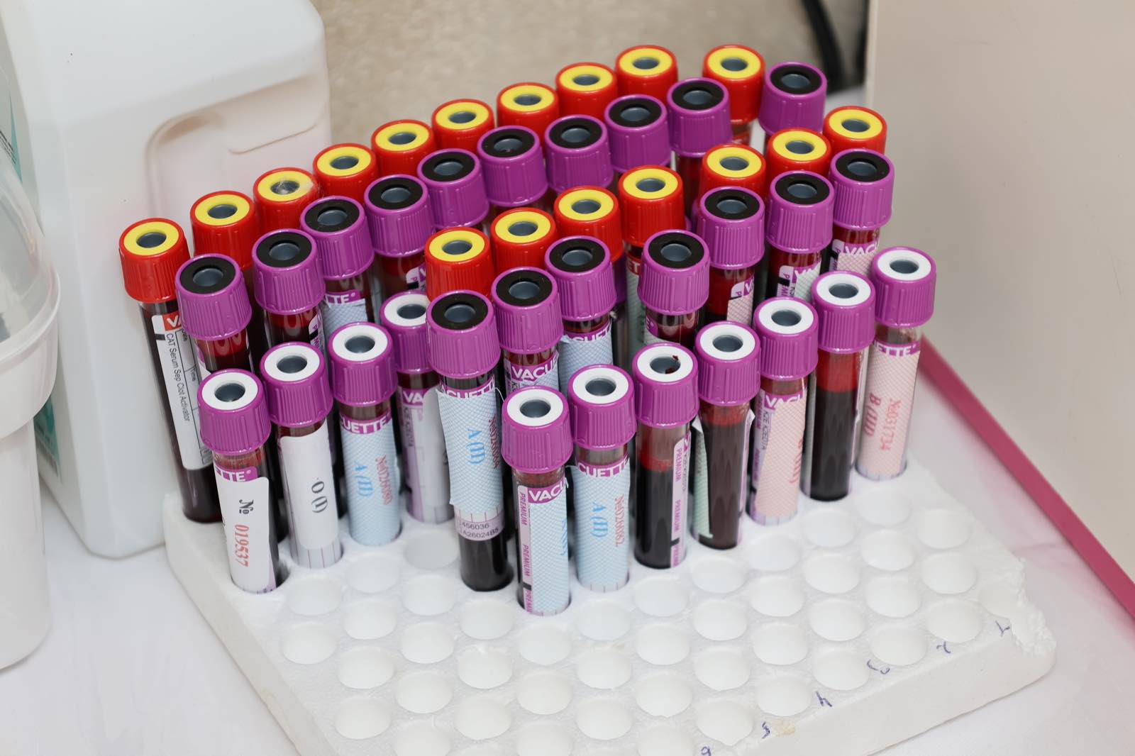 Rack of blood sample tubes in a hematology laboratory