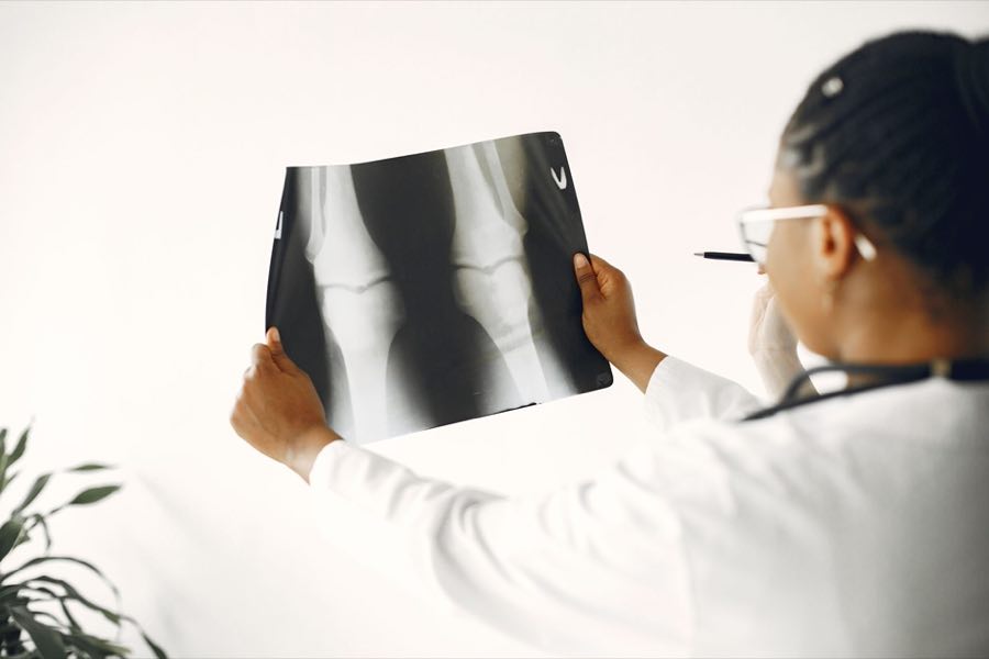 Physician evaluating a knee X-ray against the light