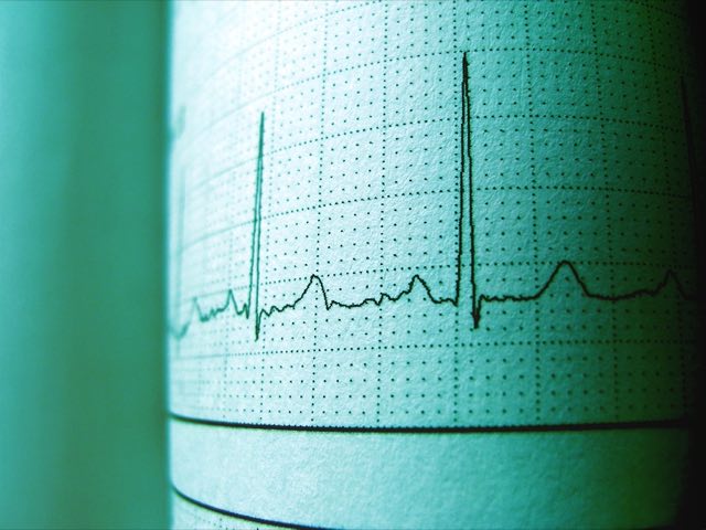 Cardiac monitoring equipment in a hospital setting