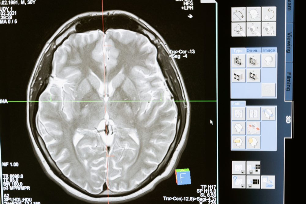 Neural activity visualized in vivid detail