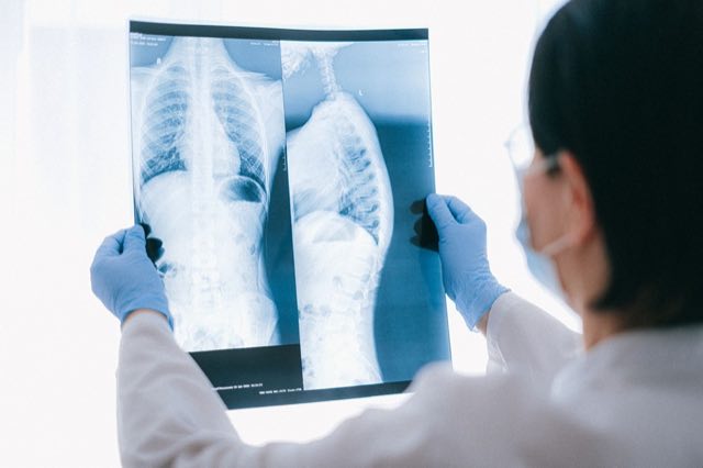 Respiratory therapy and ventilation equipment