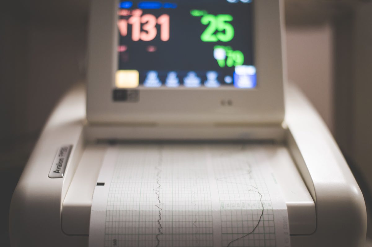 An electronic patient monitoring machine displaying traces