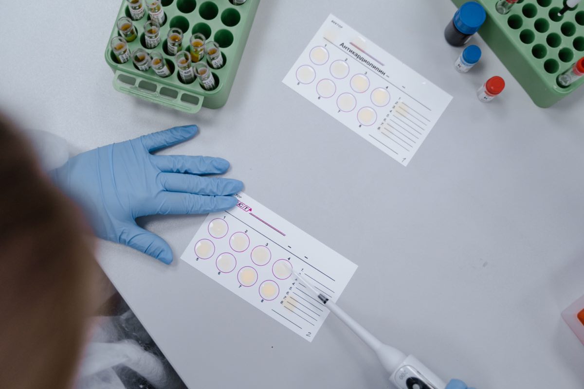 Scientist analyzing long-term safety samples in an immunology laboratory