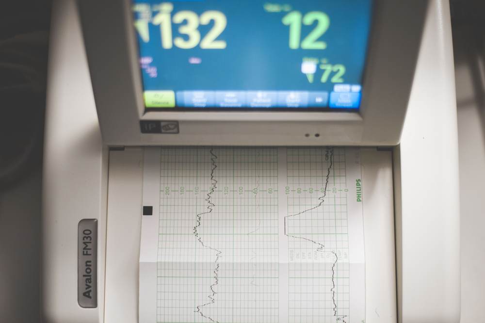 An ECG monitor displaying heart rate data