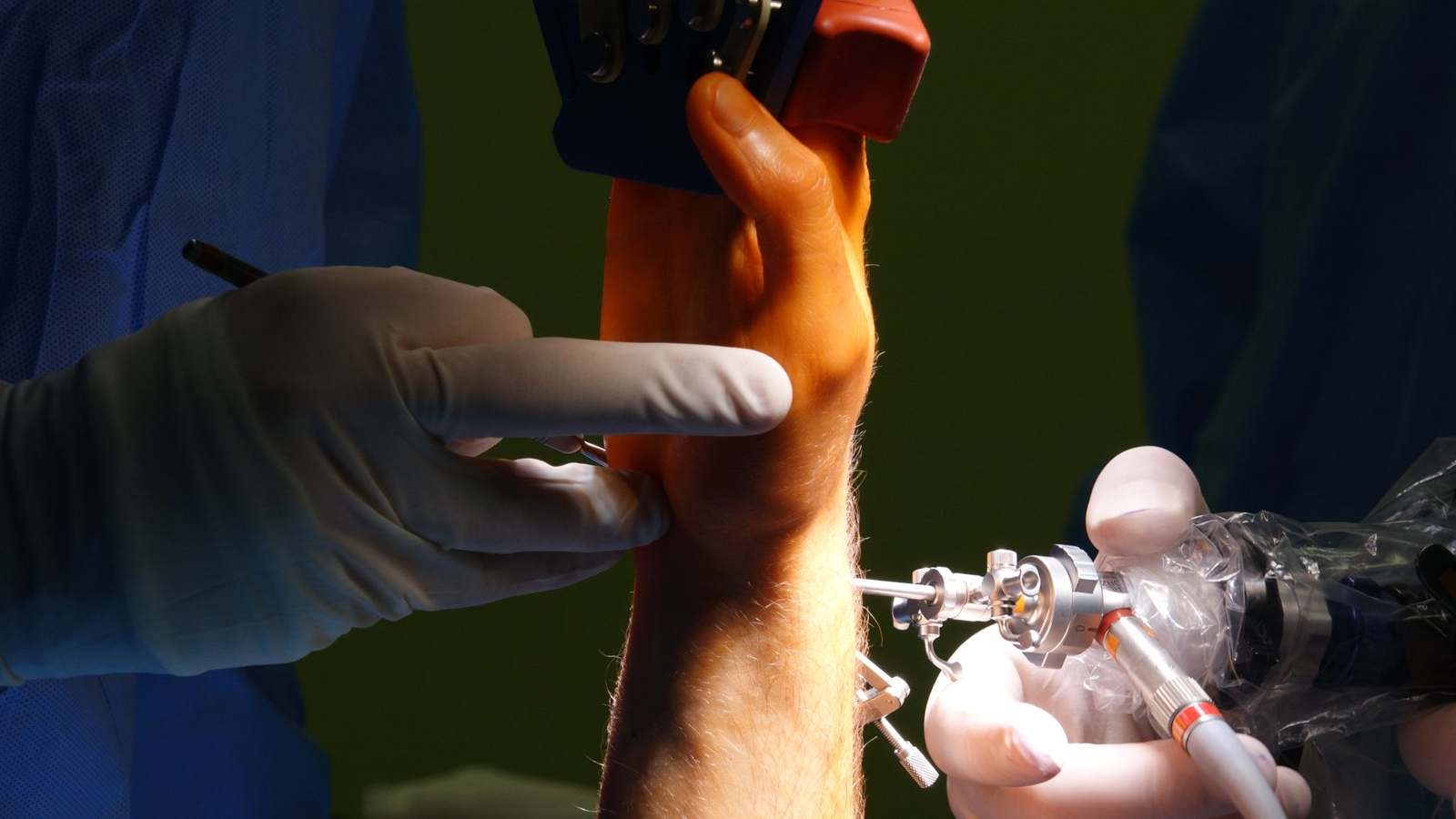 A detailed view of a wrist surgery procedure with instruments in use
