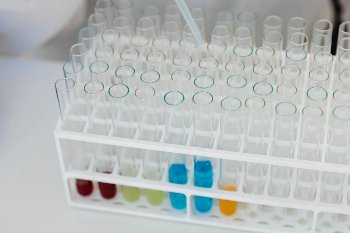 A laboratory test tube rack with labeled samples