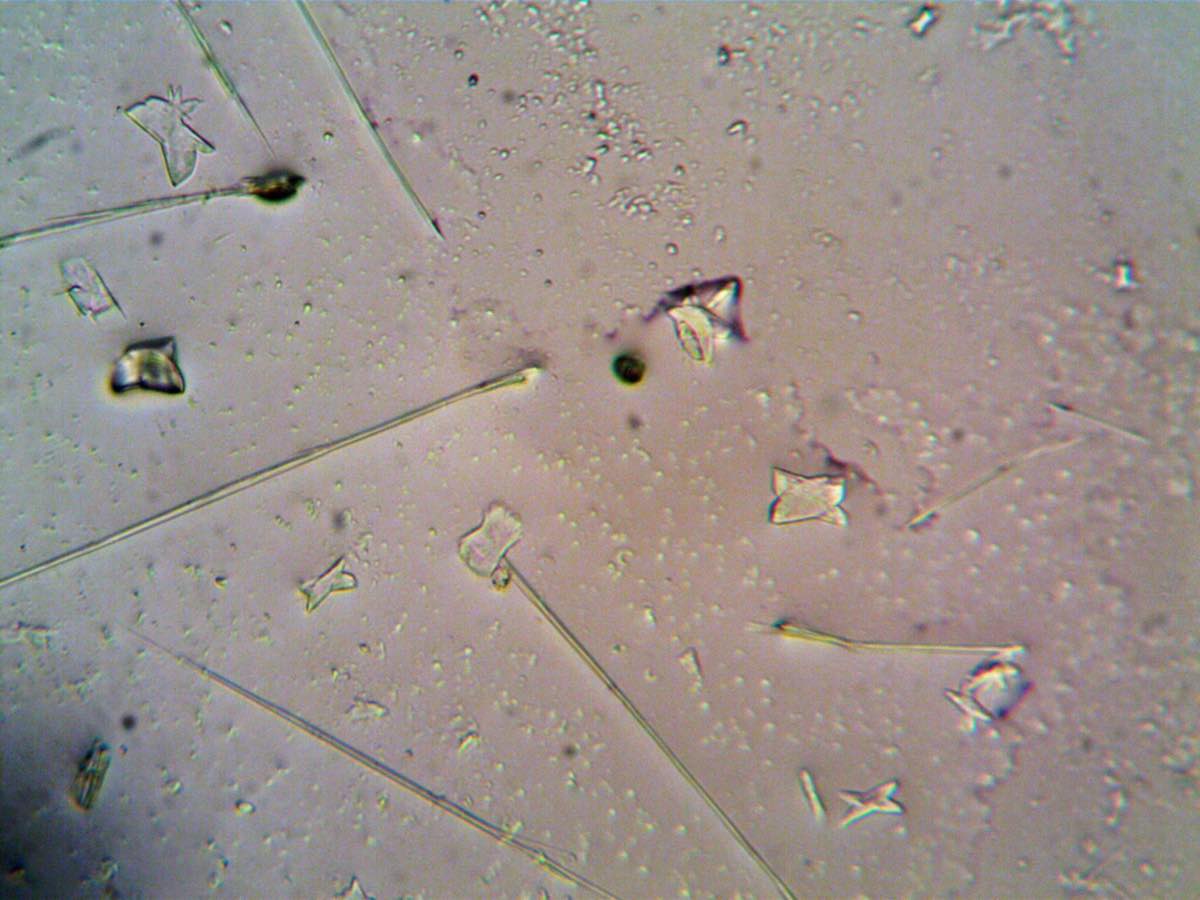 Microscopic characterization of a living biotherapeutic product