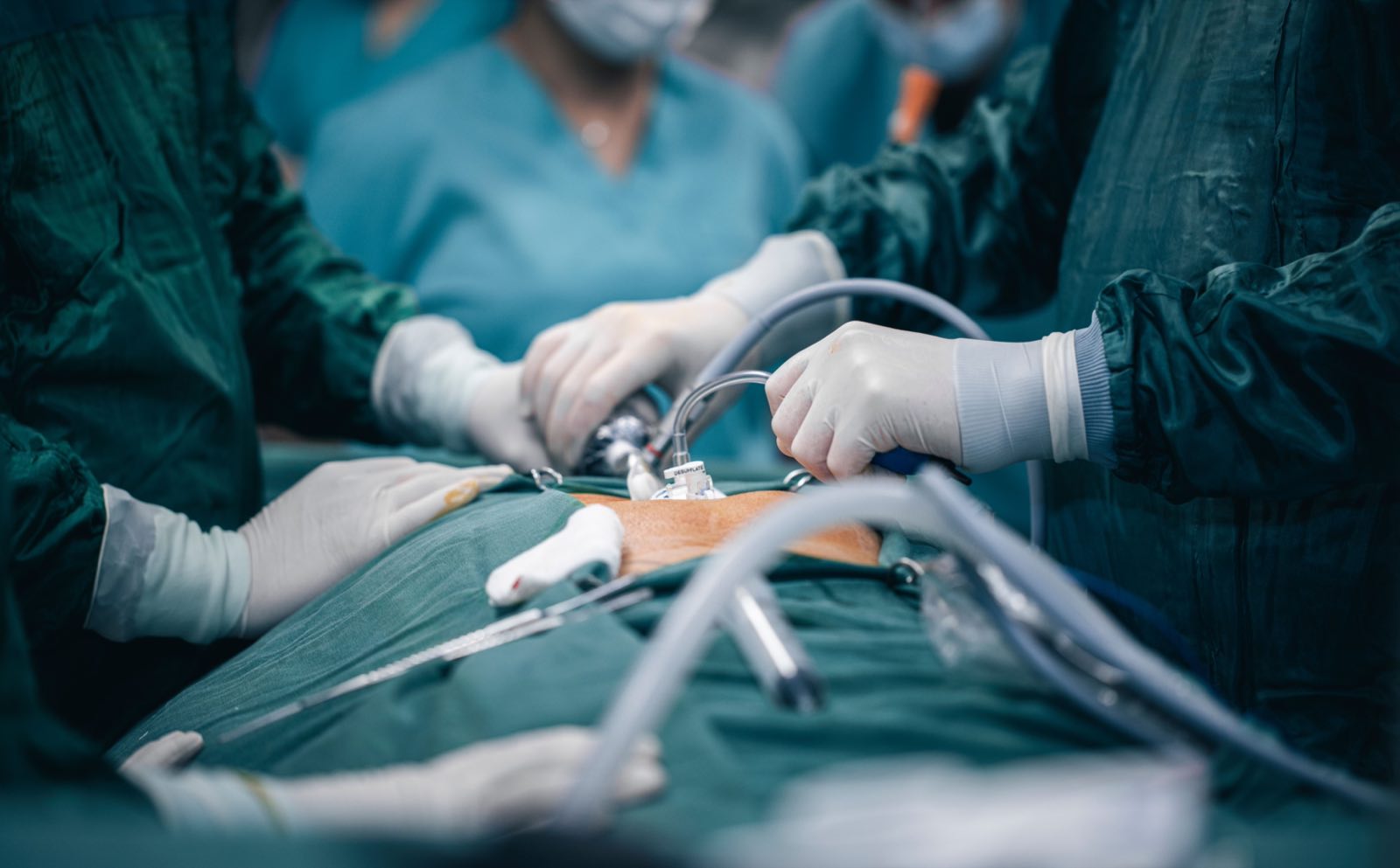 A detailed view of surgeons in action during an operation, highlighting surgical precision