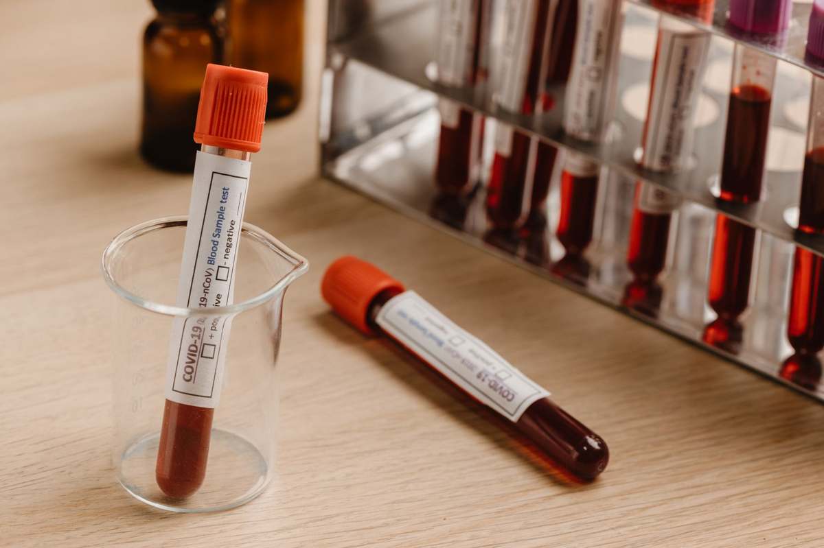 Blood sample tubes in a laboratory rack