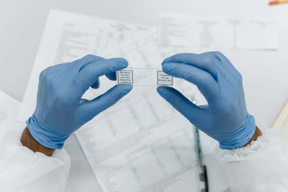 A researcher holding labeled microscope slides while wearing gloves