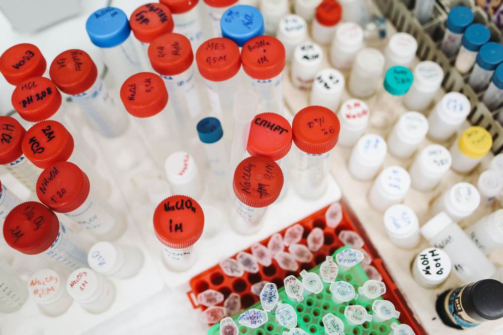 Laboratory test tubes with colorful caps and labels