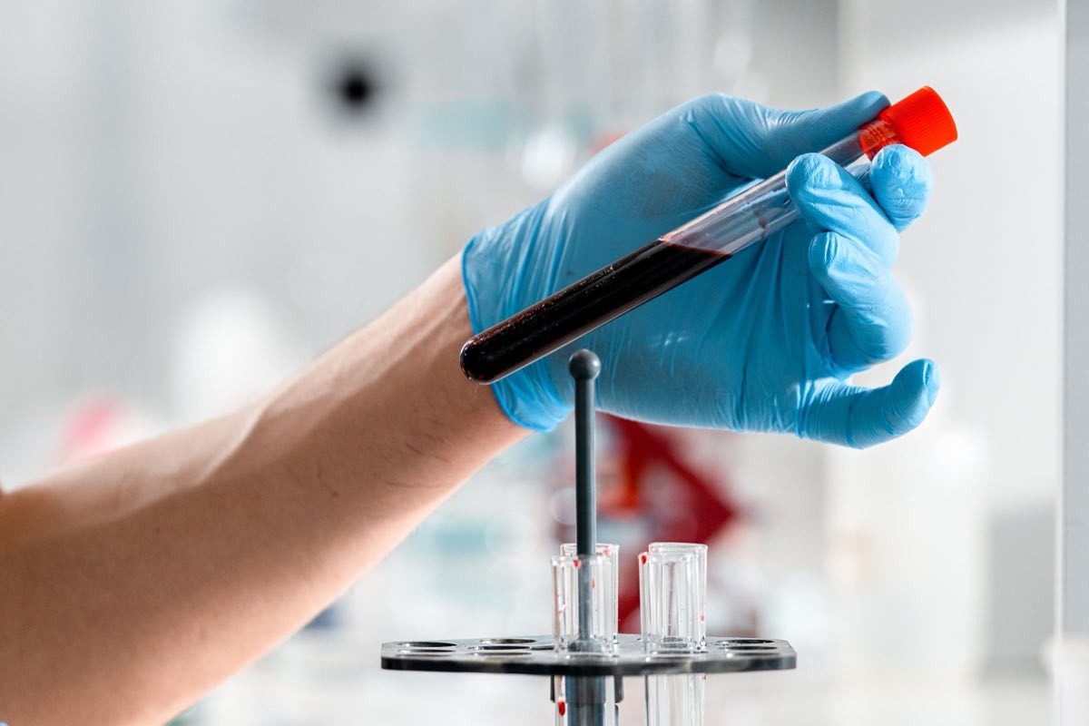 Close-up of a gloved hand holding a test tube with blood sample in a clinical research lab