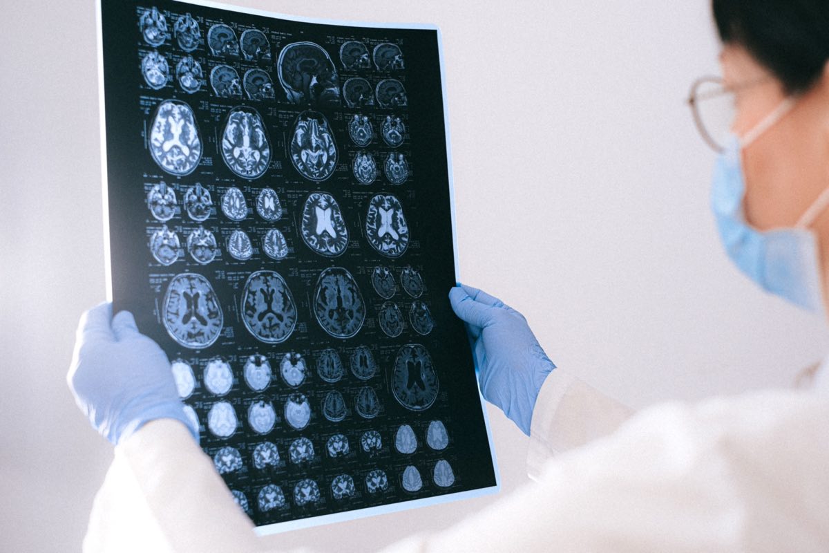 Neuroscience regulatory scientist reviewing brain imaging