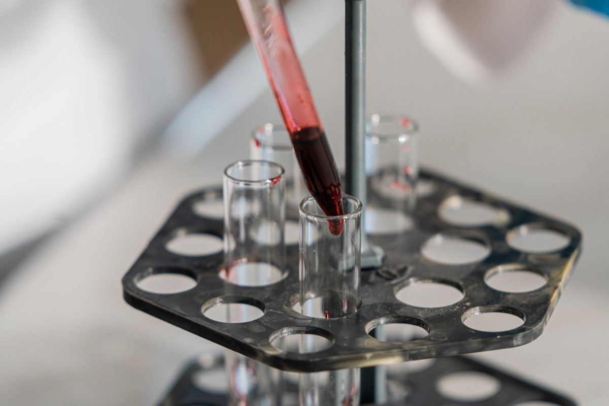 Samples being prepared for toxicology analysis
