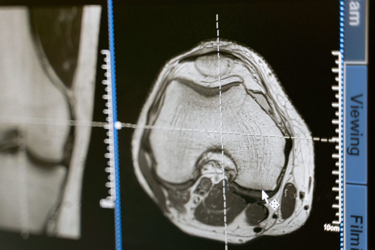 Close-up of an MRI scan displayed on a medical monitor, showcasing diagnostic medical imaging technology