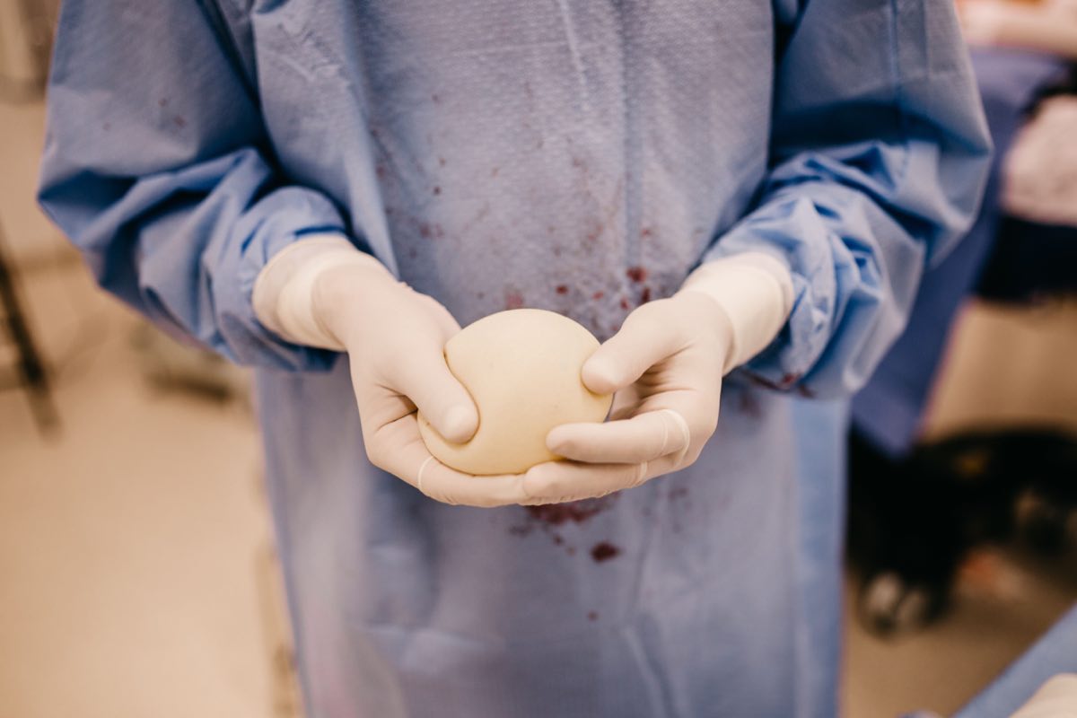 Close-up of a surgeon holding a silicone implant prepared for surgery