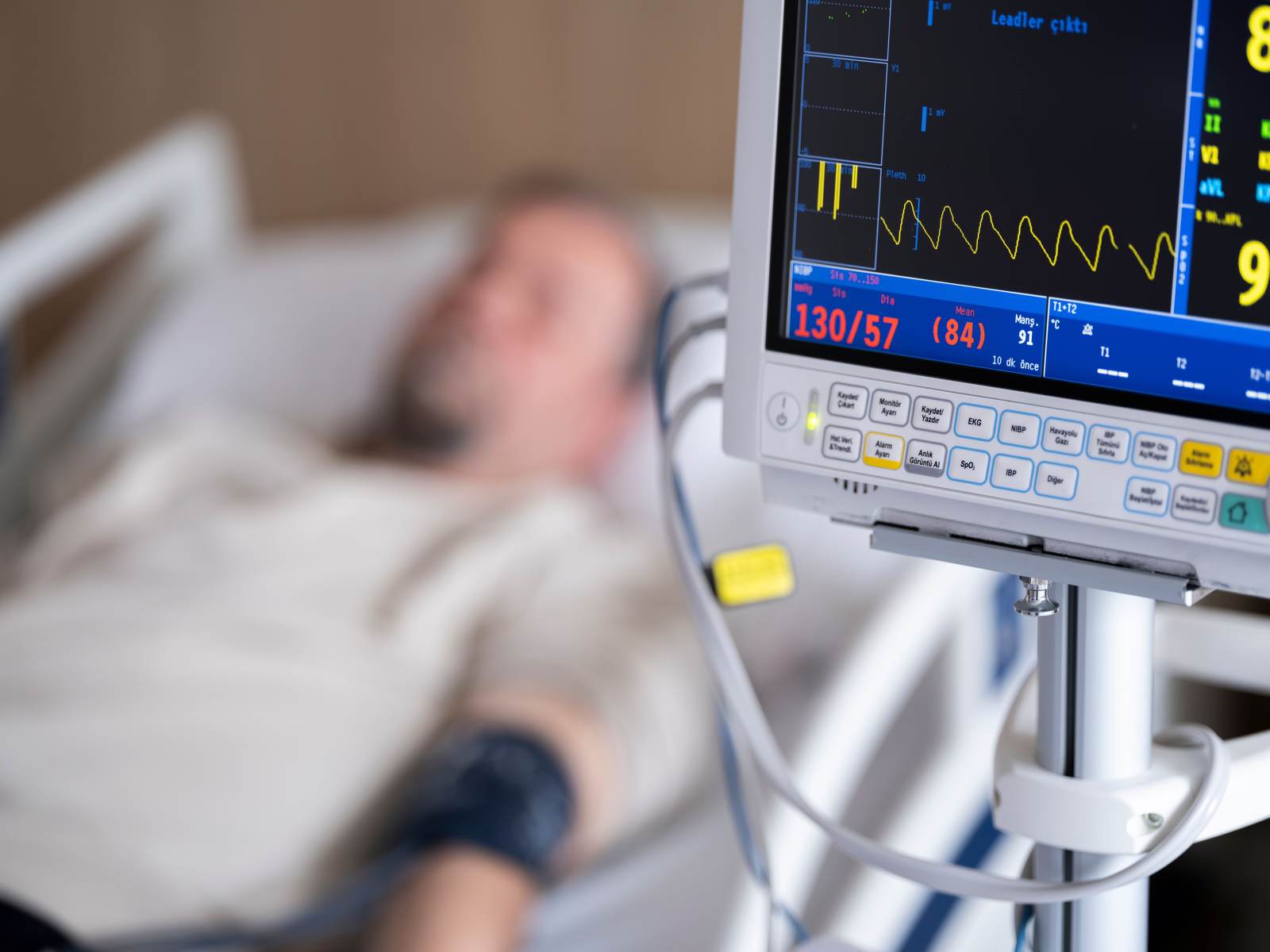 A patient in a hospital bed connected to a heart monitor