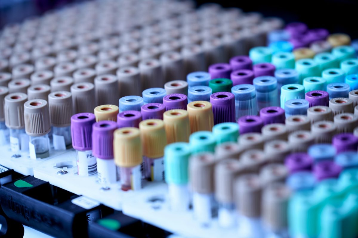 Sample tubes staged for analysis in a pharmaceutical laboratory
