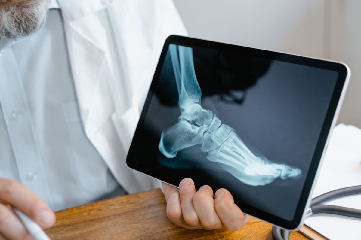 A clinician reviewing a foot X-ray on a tablet