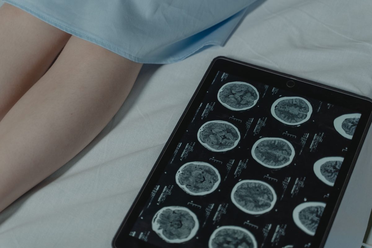 A brain CT scan displayed on a tablet beside a patient in a hospital room