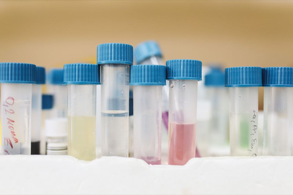 Capped sample tubes held in frozen storage