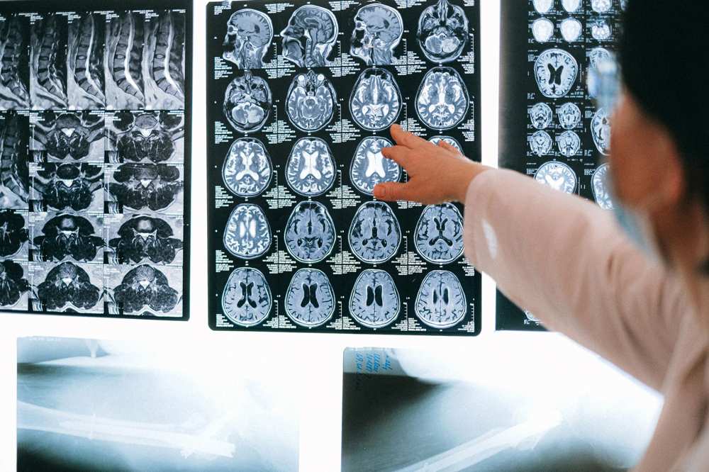 Physician reading a wall of brain MRI and CT scans