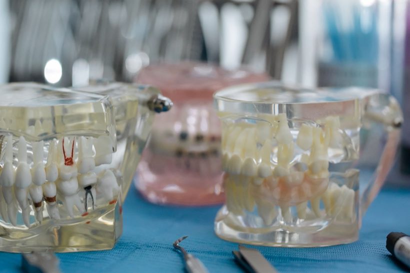 Dental models with teeth arrangement on a table, ideal for health and education visuals