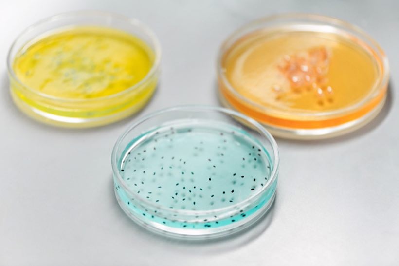 Colorful culture plates in a microbiology laboratory