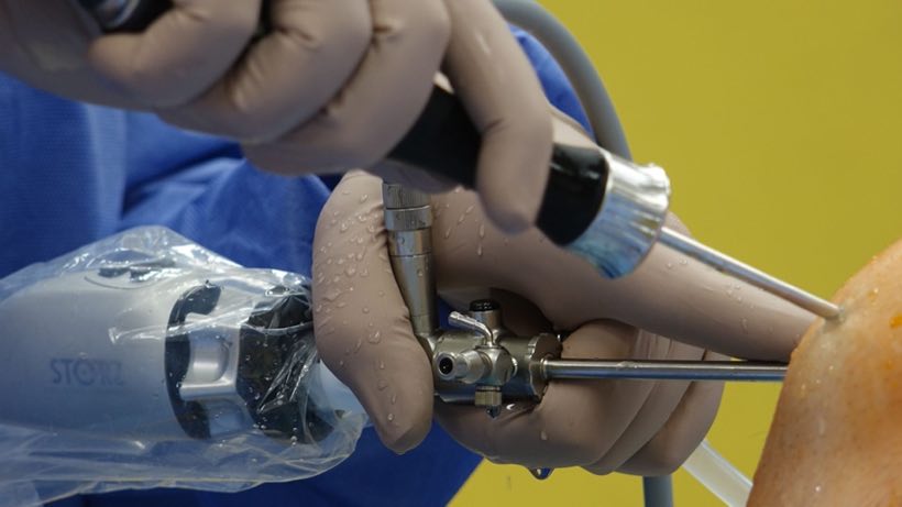 Surgeon performing arthroscopic knee surgery using specialized equipment