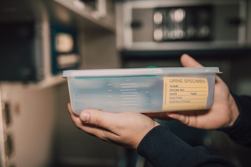 Close-up of hands holding a urine specimen container in a lab environment