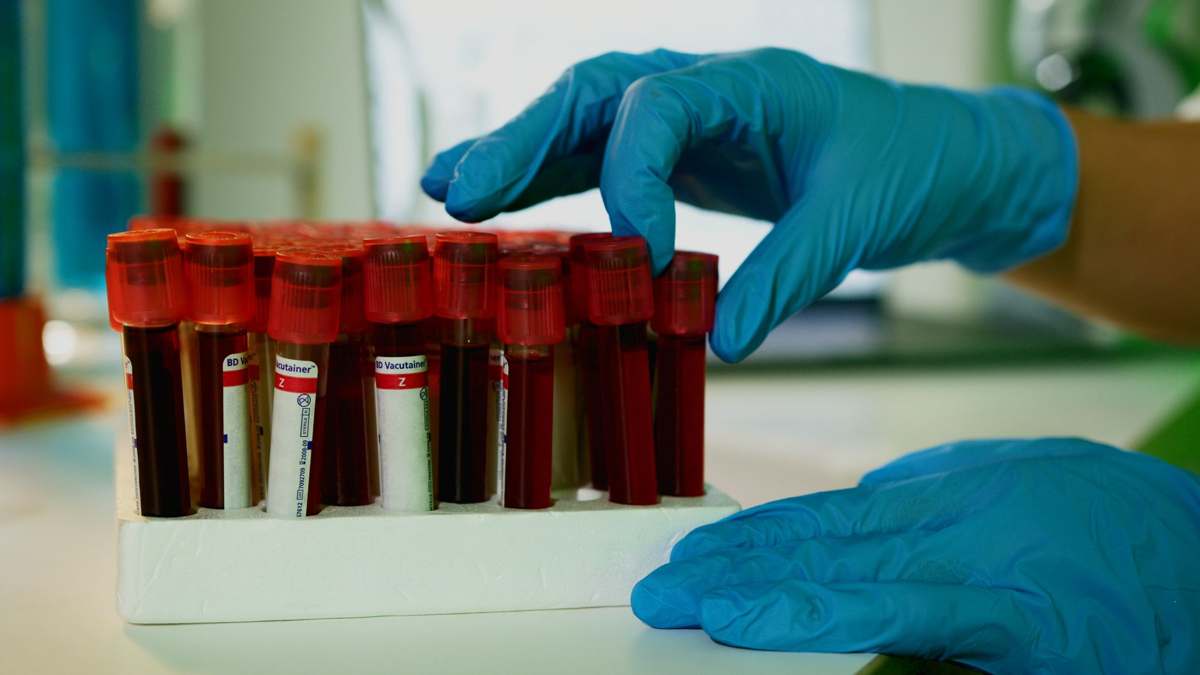 A laboratory technician handling vials in a laboratory setting